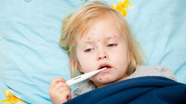 pictures of Viral illnesses in Children
