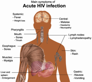 aids, hiv, human immunodeficiency virus, acquired immunodeficiency syndrome