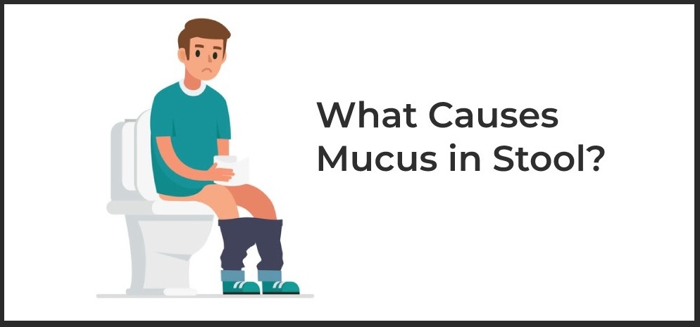 Mucus in Stool Causes and Treatment