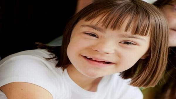 Living with Down Syndrome