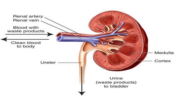 Acute kidney failure