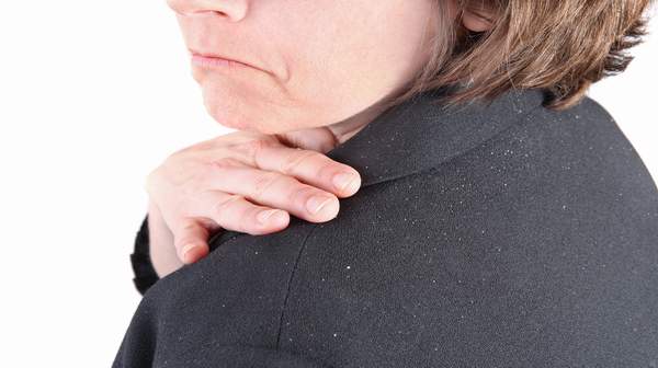 Picture woman with dandruff