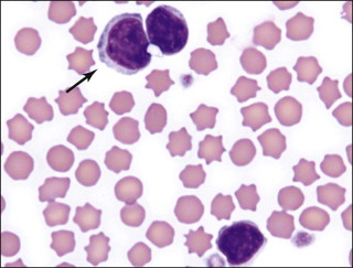 reactive-lymphocytes