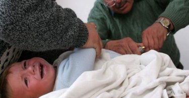 Male Circumcision: Benefits & Risks