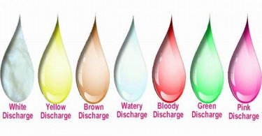 Different Types of Vaginal Discharge